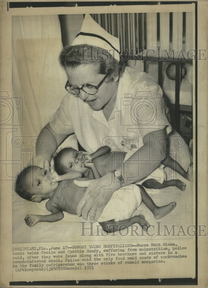 1971 Press Photo Malnourished Twins Hospitalized - RRW46823 - Historic Images