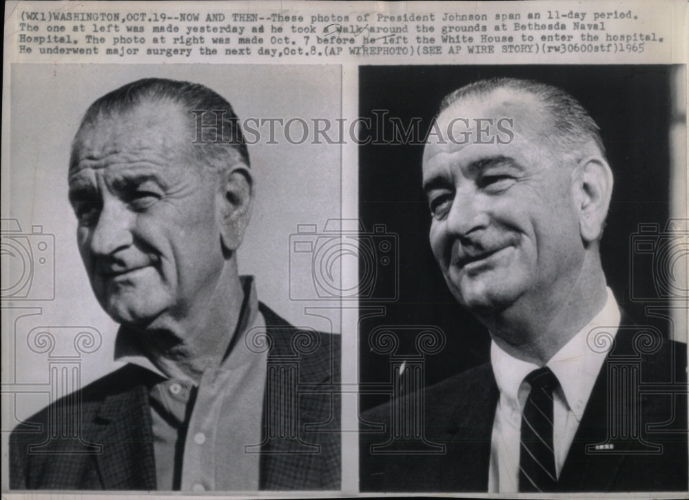 1965 Press Photo President Johnson Surgery Hospital - RRW57457 - Historic Images