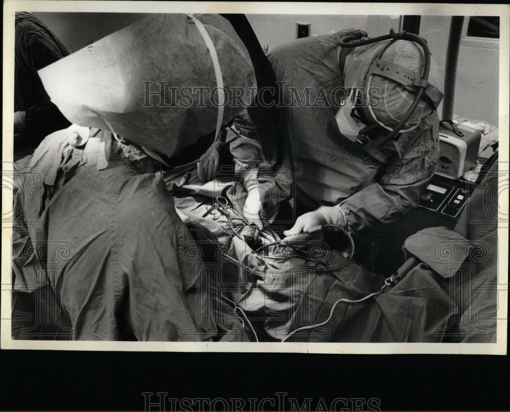 1981 Press Photo Cerullo Surgery patient vassels hand - RRW58499 - Historic Images