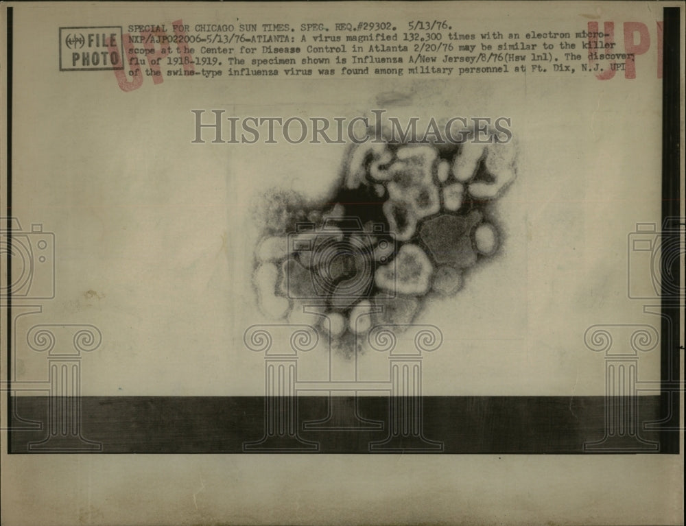 1976 Press Photo Atlanta virus magnified microscope - RRW65349 - Historic Images