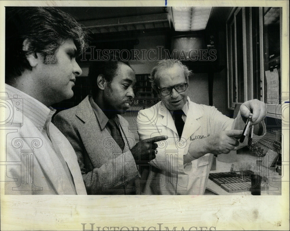 1983 Press Photo Sickle Cell Anemia - RRW65831 - Historic Images