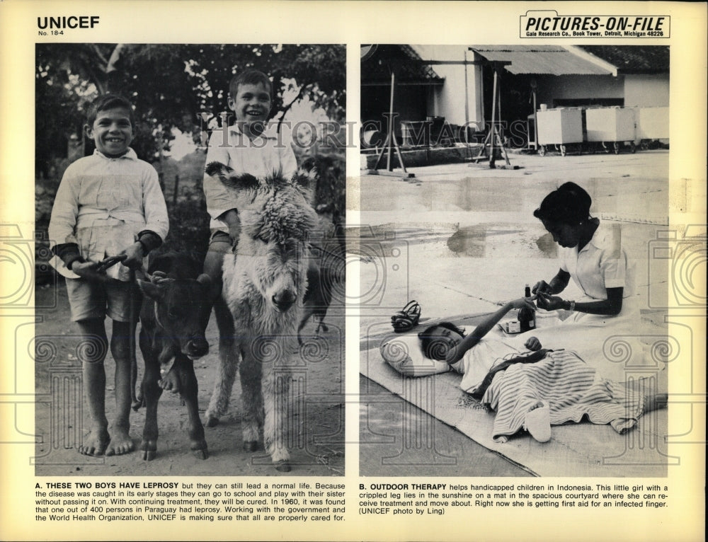 1967 Press Photo TWO BOYS HAVE LEPROSY HANDICAPPED - RRW67199 - Historic Images