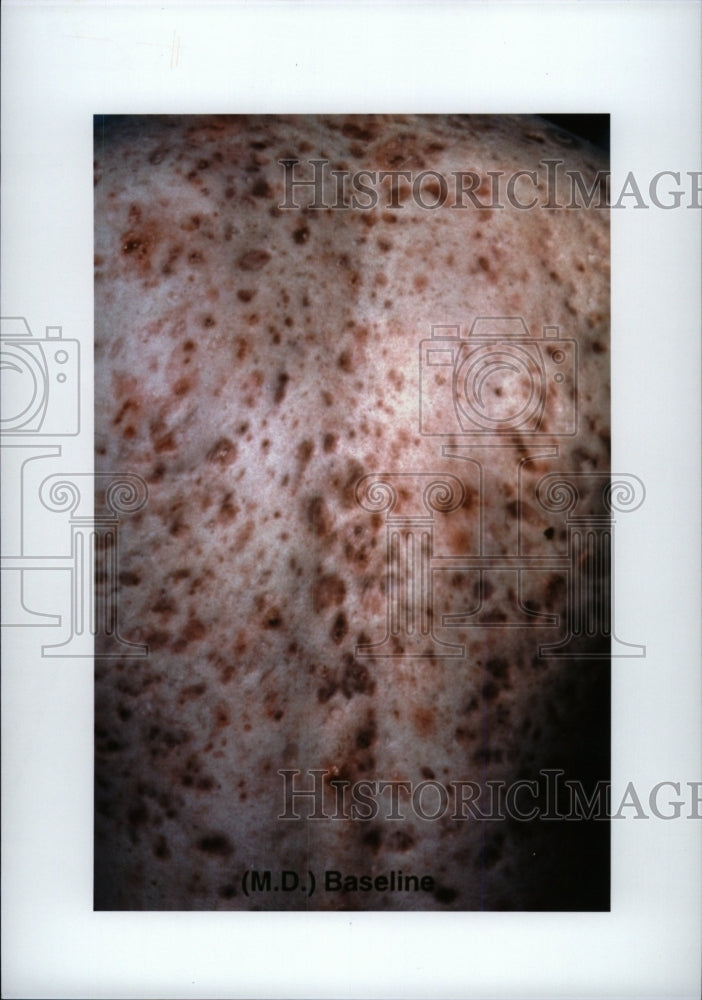 None Disease Abnormal Condition Affect Body Organism - RRW98533 - Historic Images