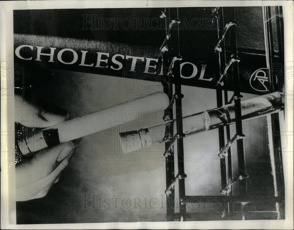 1967 Blood Plasma/High Cholesterol/Health - Historic Images