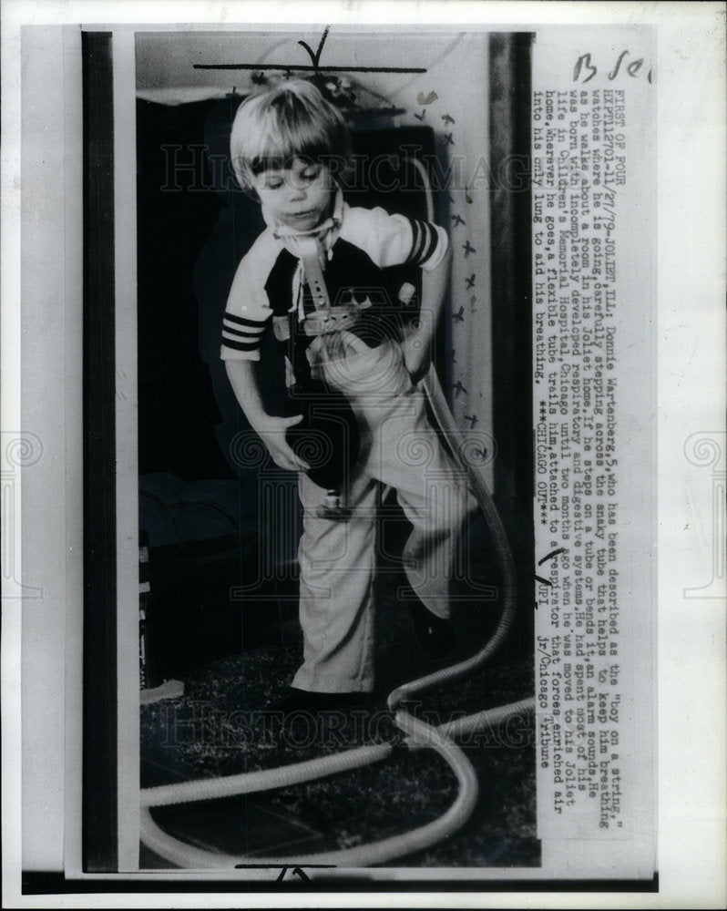 1979 Press Photo Wartenberg breathing tube boy step - Historic Images
