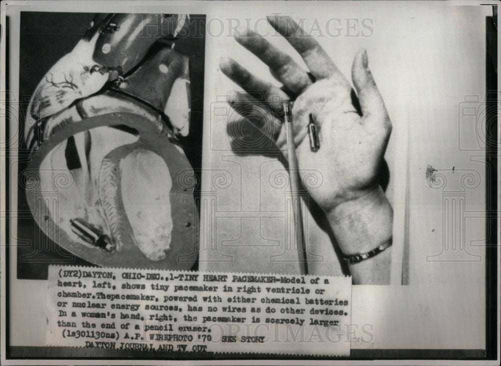 1970 Press Photo Tiny heart pacemaker - Historic Images