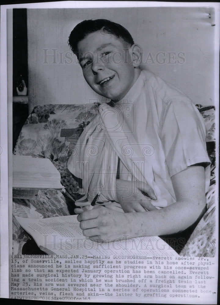 1963 Press Photo Everett Knowles/Surgery/Arm Grafted - Historic Images