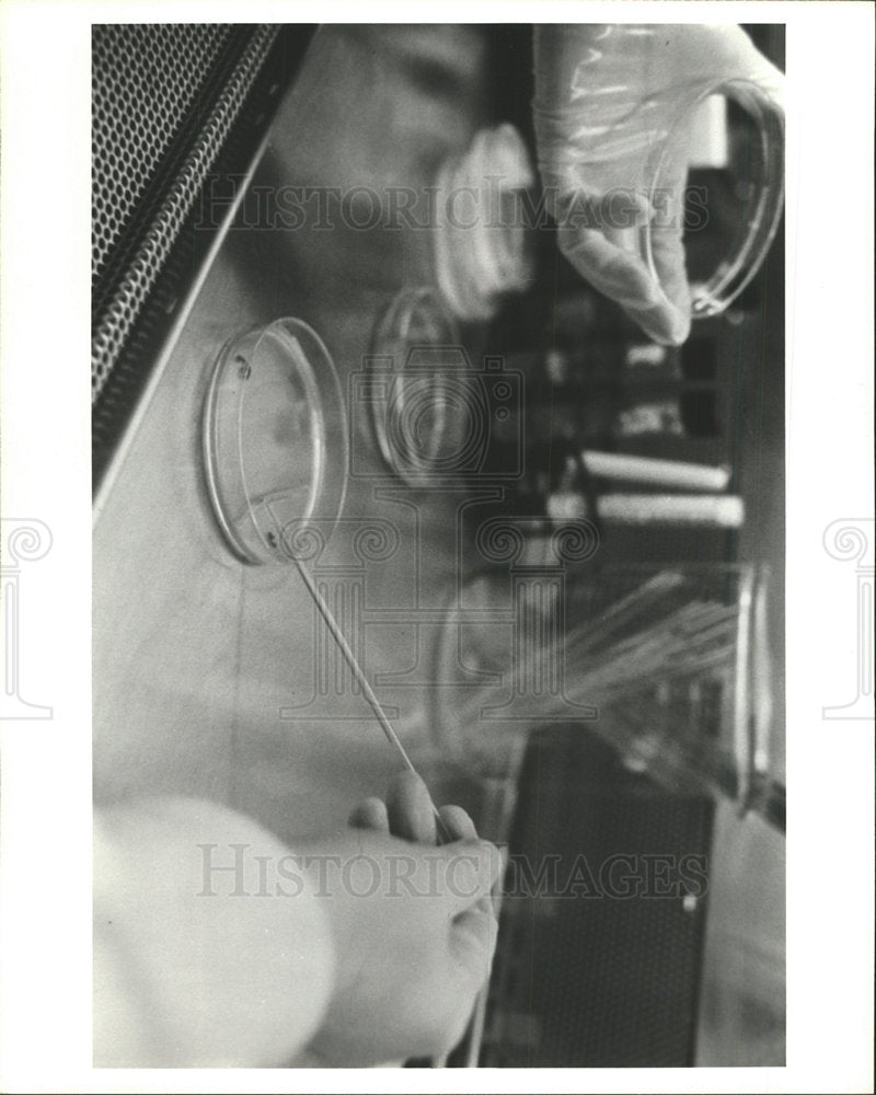 1981 Press Photo Micro Organisms - Historic Images