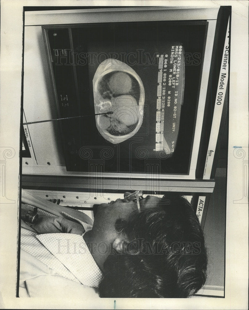 1976 Press Photo Michael Reese Hospital Radiology - Historic Images