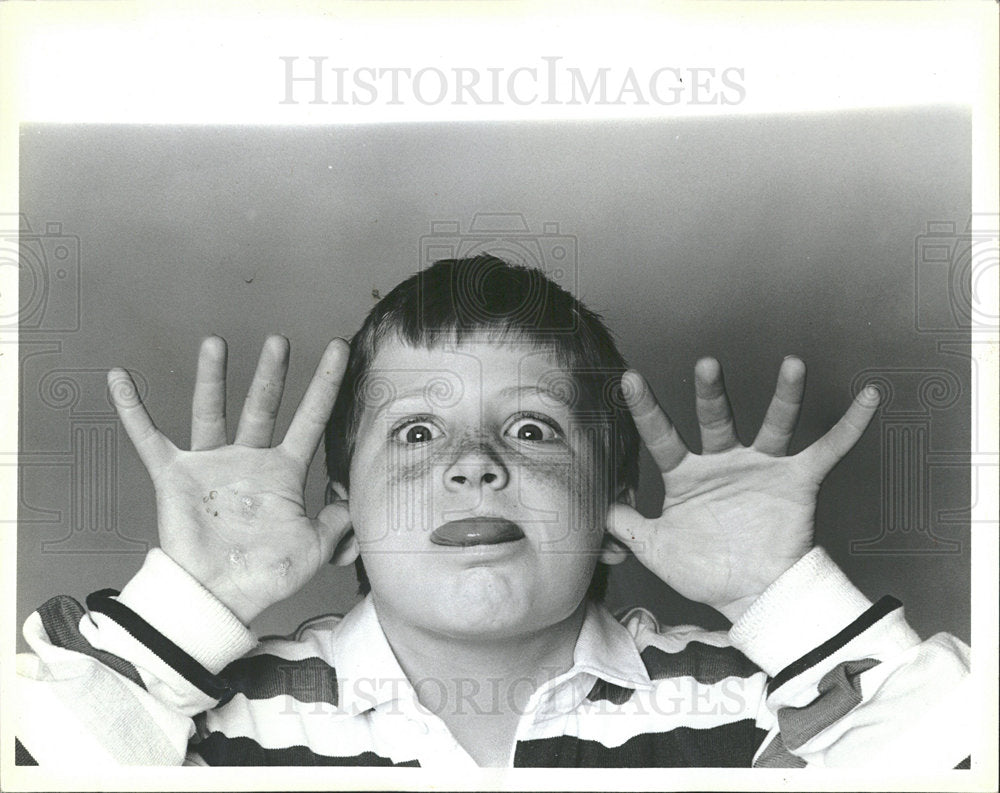 1986 Press Photo Family Clown Child Alcoholic Parent - Historic Images