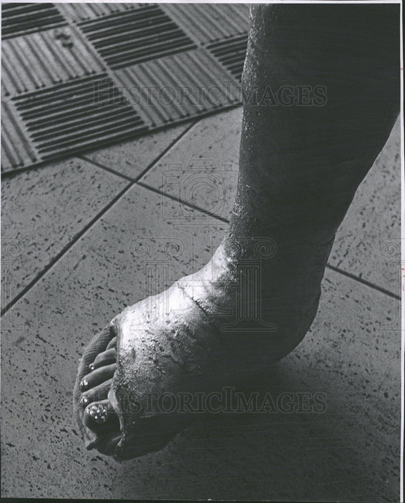 1962 Press Photo Mrs. Giles Florence Gold Casted Leg - Historic Images