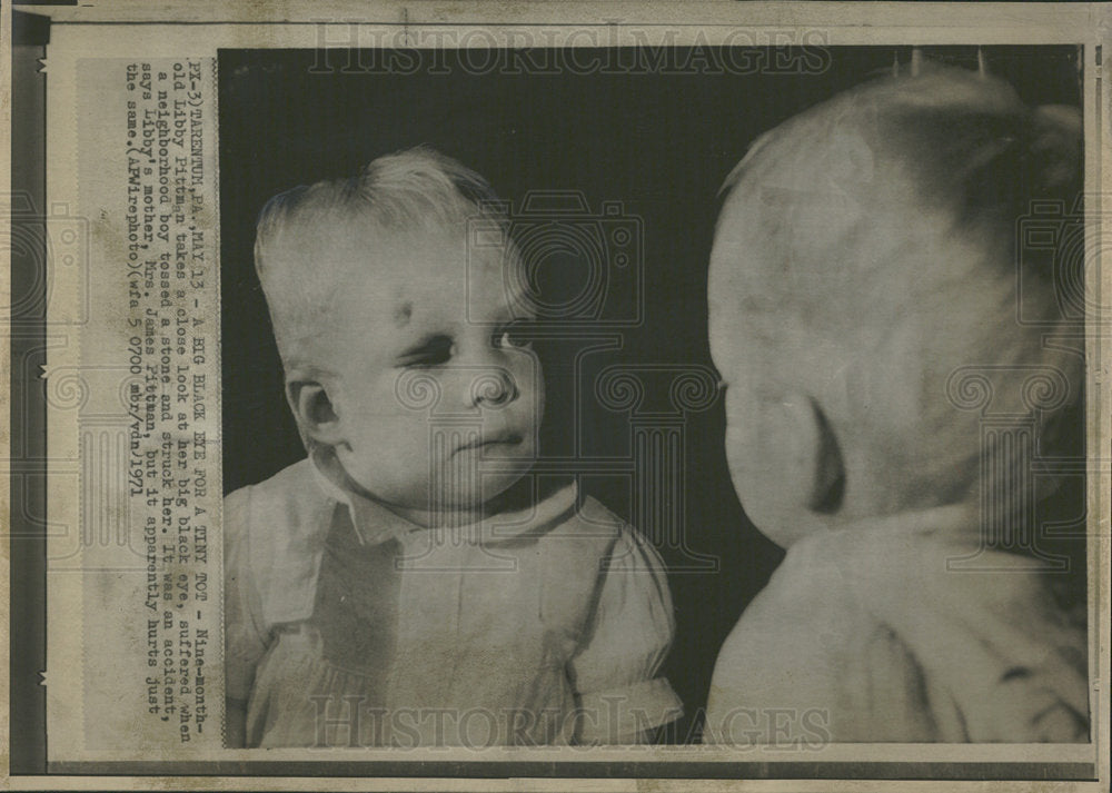 1971 Press Photo Libbty Pittman black eye nine month - Historic Images