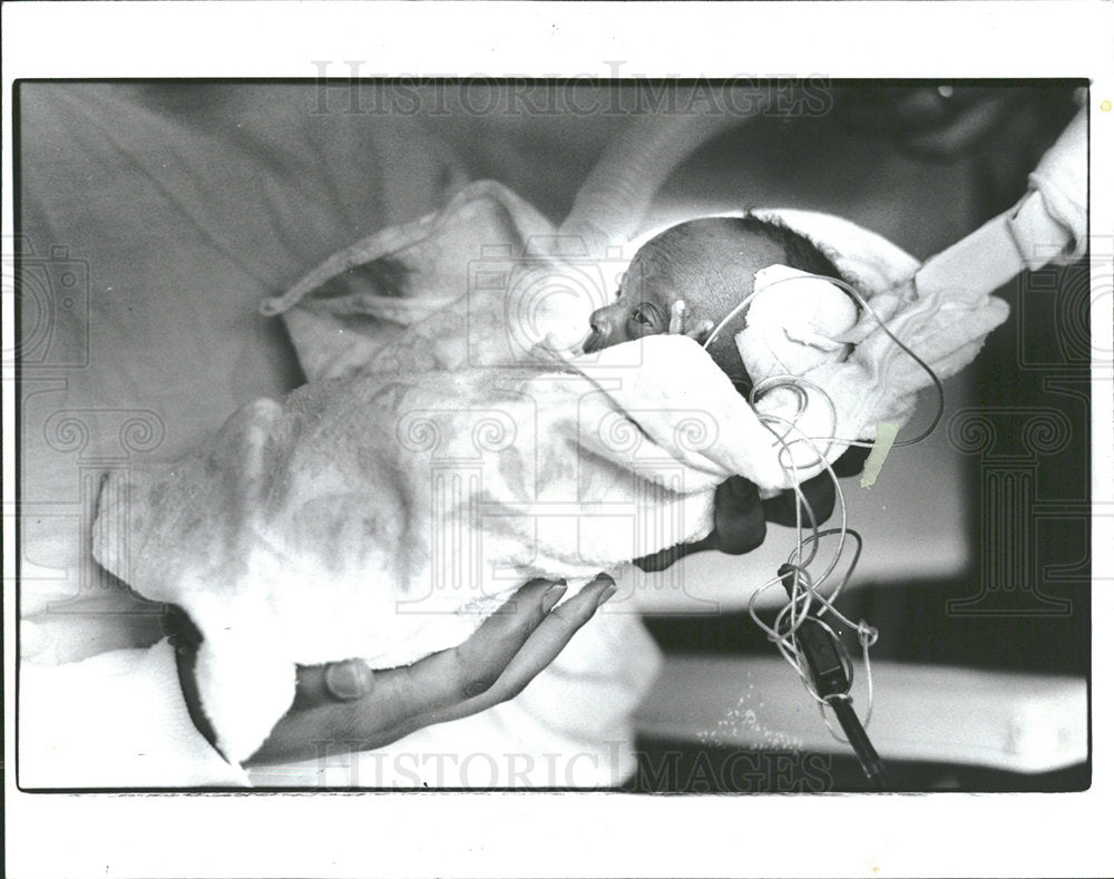 1981 Press Photo Premature Baby Lakrisha Rankin - Historic Images