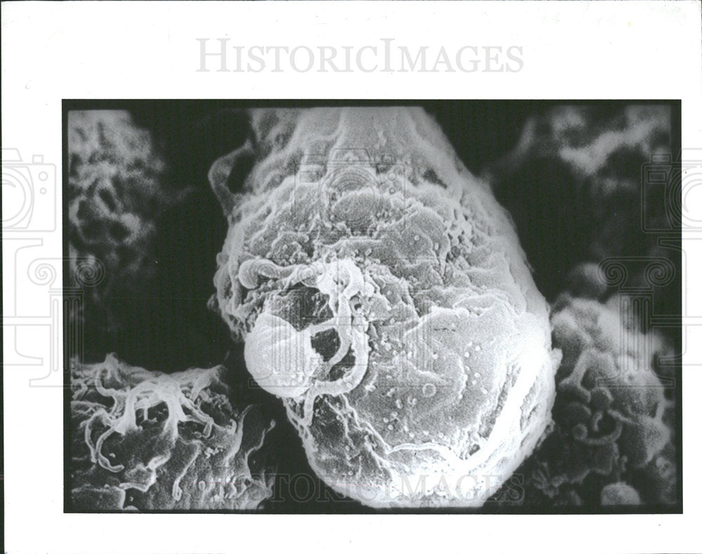 1989 Press Photo AIDS Infected Cell Enlargement - Historic Images