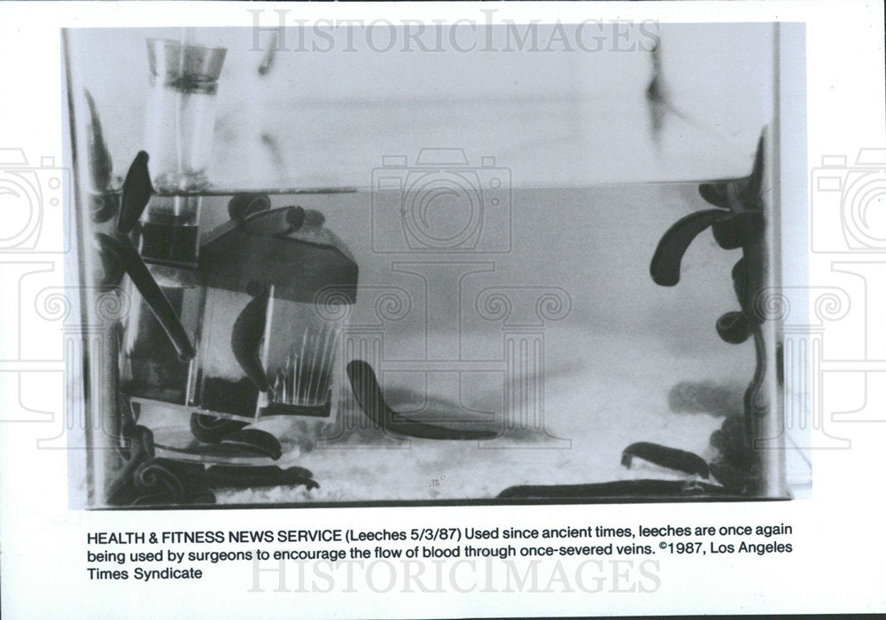 1987 Press Photo LEECHES SURGEONS - Historic Images