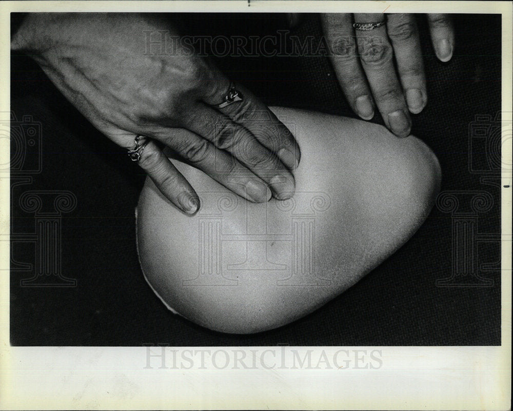 1984 Press Photo Natalie Miller Portes Cancer Breast  - Historic Images