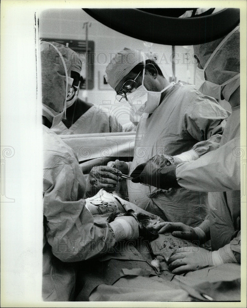 1985 Press Photo Dr Charles Bombeck heart transplant  - Historic Images