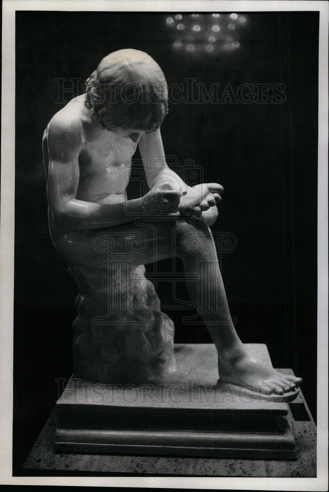 1976 Press Photo Statue Greek Boy Foot Problem Podiatry - Historic Images