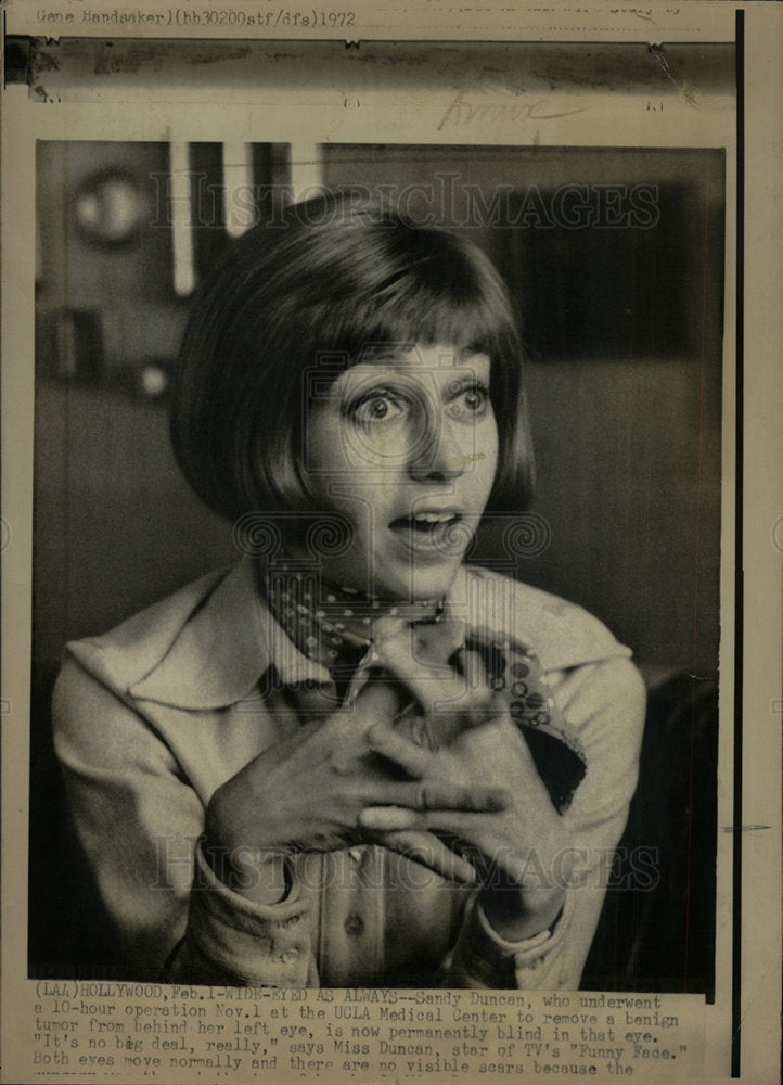 1972 Press Photo Sandy Duncan Actress Eye Operation - Historic Images