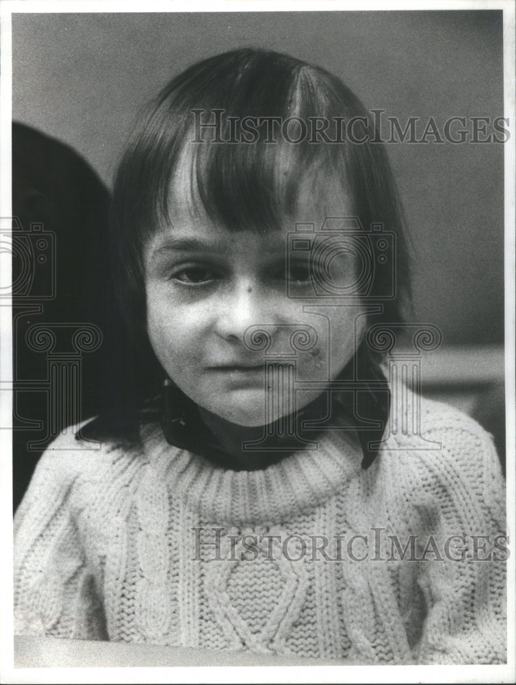 1980 Little Ricky Caruso Victim Skin Disease Karen Tummillo. - Historic Images