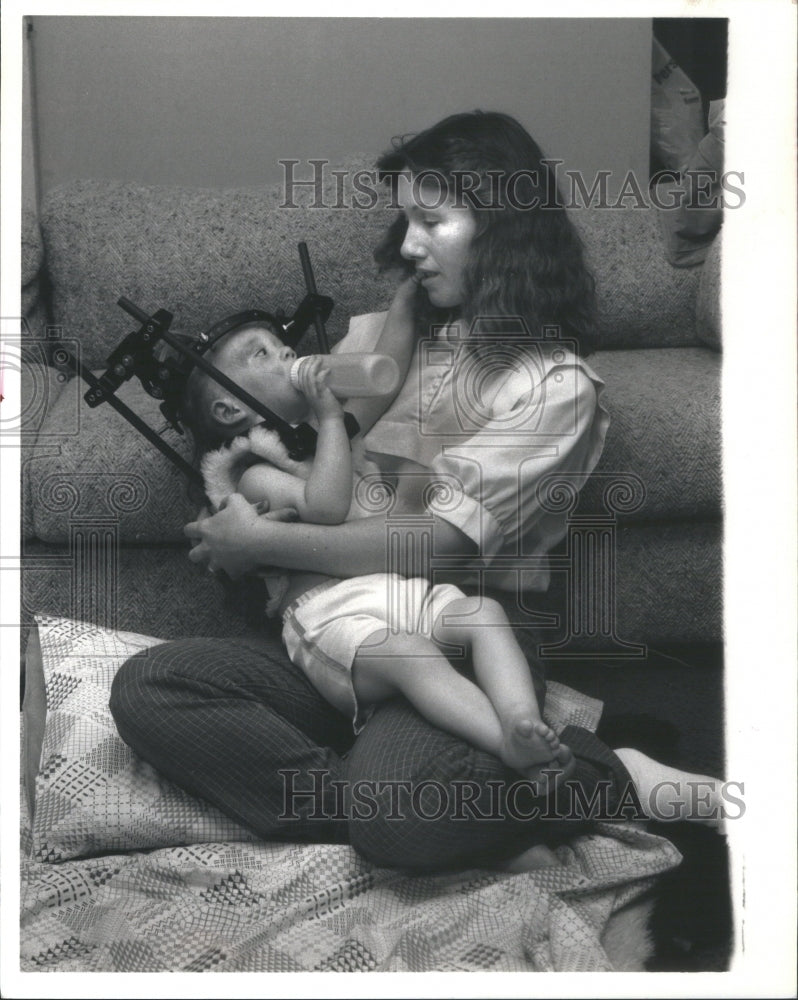 1987 Suzanne Brown 22 months old recuperates from accident - Historic Images