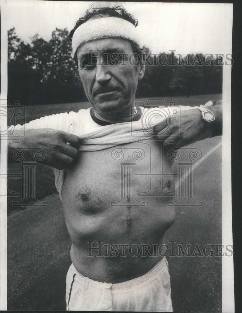 1977 Andrew Anton Heart Surgery Patient Chicago Area - Historic Images