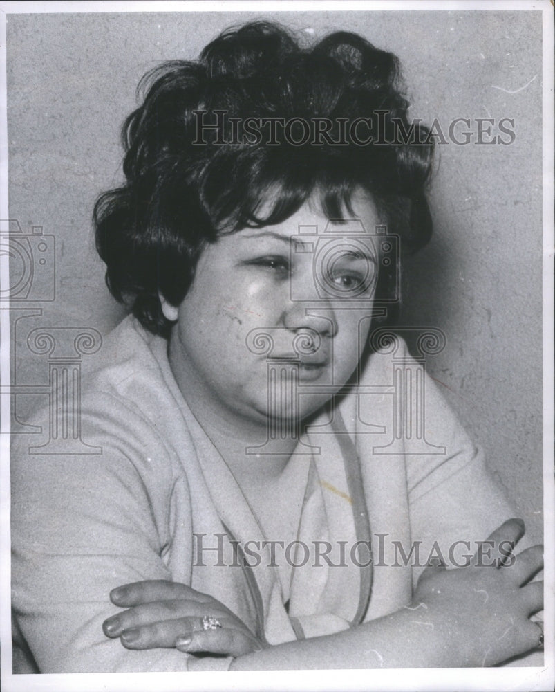 1967 Sherry Arrigo,  victim of subway beating. - Historic Images