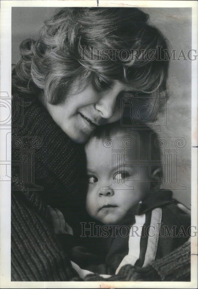 1982 Woman With Hodgkins Disease Holding Adopted Son - Historic Images