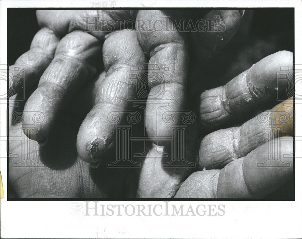 1985 Press Photo Effects of the CSX toxic spill - Historic Images