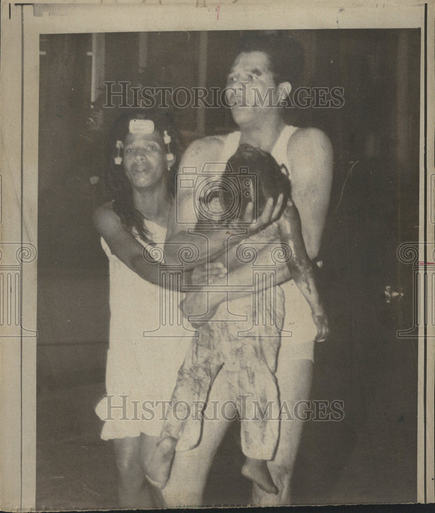 1972 Press Photo Child Injured In Fire - Historic Images