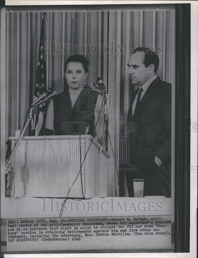 1966 Press Photo Robert DePugh anti communist Minutemen Bruised Secretary arm - Historic Images