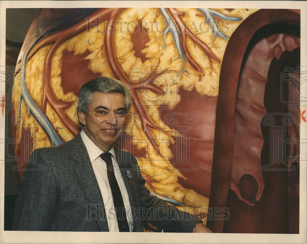 1988 Press Photo Heart-Transplant Recipient Tom Carbol In Front Of Heart - Historic Images