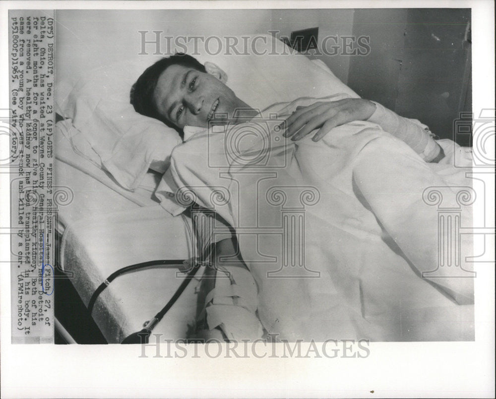 1965 Press Photo James Fitch Wayne County General Hospital Detroit Delta Ohio - Historic Images