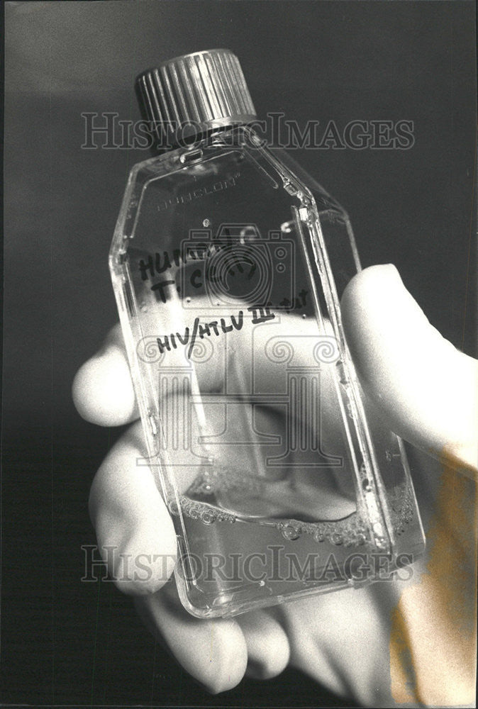 1987 Press Photo Human T-Cells Aids Virus Research - Historic Images