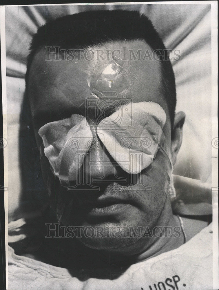 1967 Press Photo His left eye seriously injured, Patrolman Robert Astraus rests - Historic Images