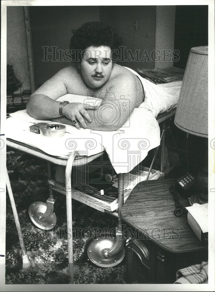 1977 Press Photo Allen Jackson who was amputated at the navel - Historic Images