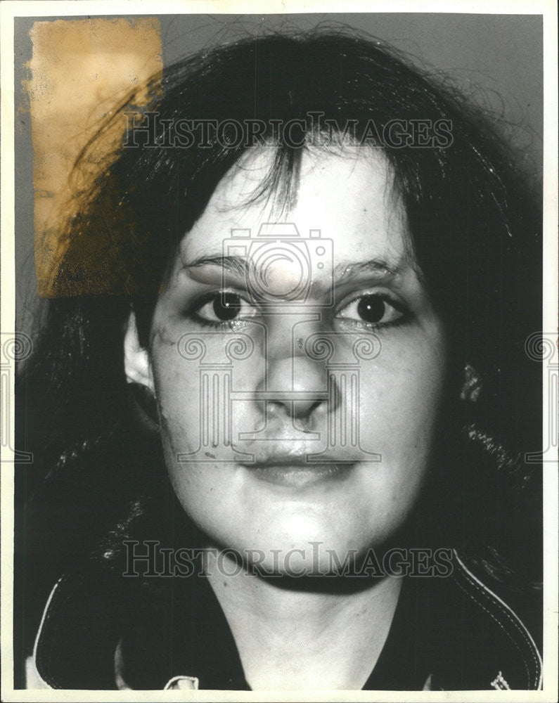 1984 Press Photo Debbie Miller Koziarz North Shore Model Plastic Surgery - Historic Images