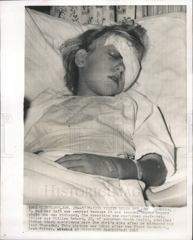 1965 Press Photo Kidnape victim Dorris Adkins loses eye due to unrepairable damage - Historic Images