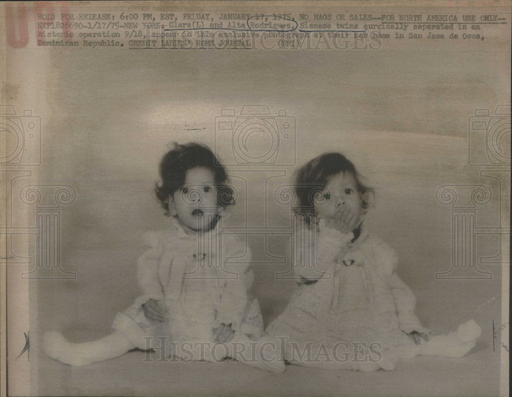 1975 Clara Rodriguez Twins Surgically Separated In Operation In Home - Historic Images