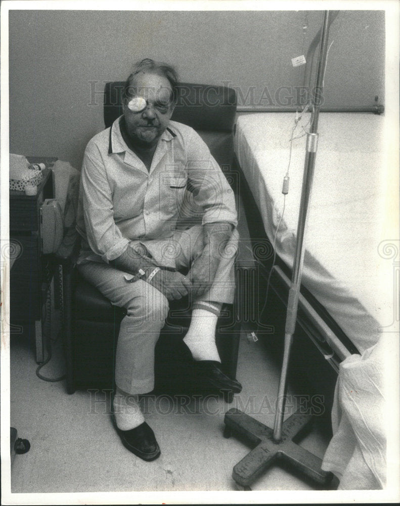 1987 Press Photo Jeweler Harry Price With Effects of Pistol Whipping his Face. - Historic Images