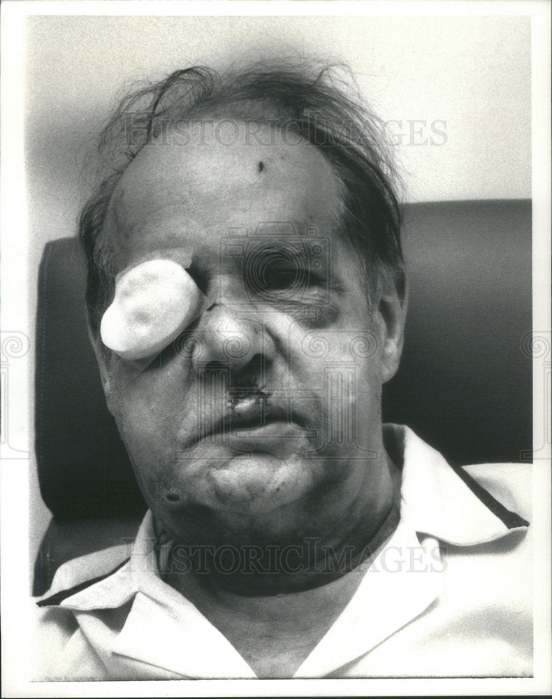 Press Photo Harry Price Blue Island Jewelry Robbery Francis Hospital - Historic Images