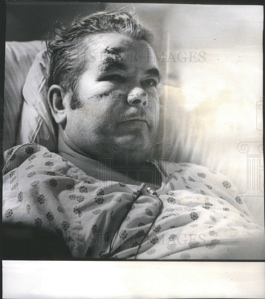 1973 Patrolman Robert Pigott After Being Shot - Historic Images