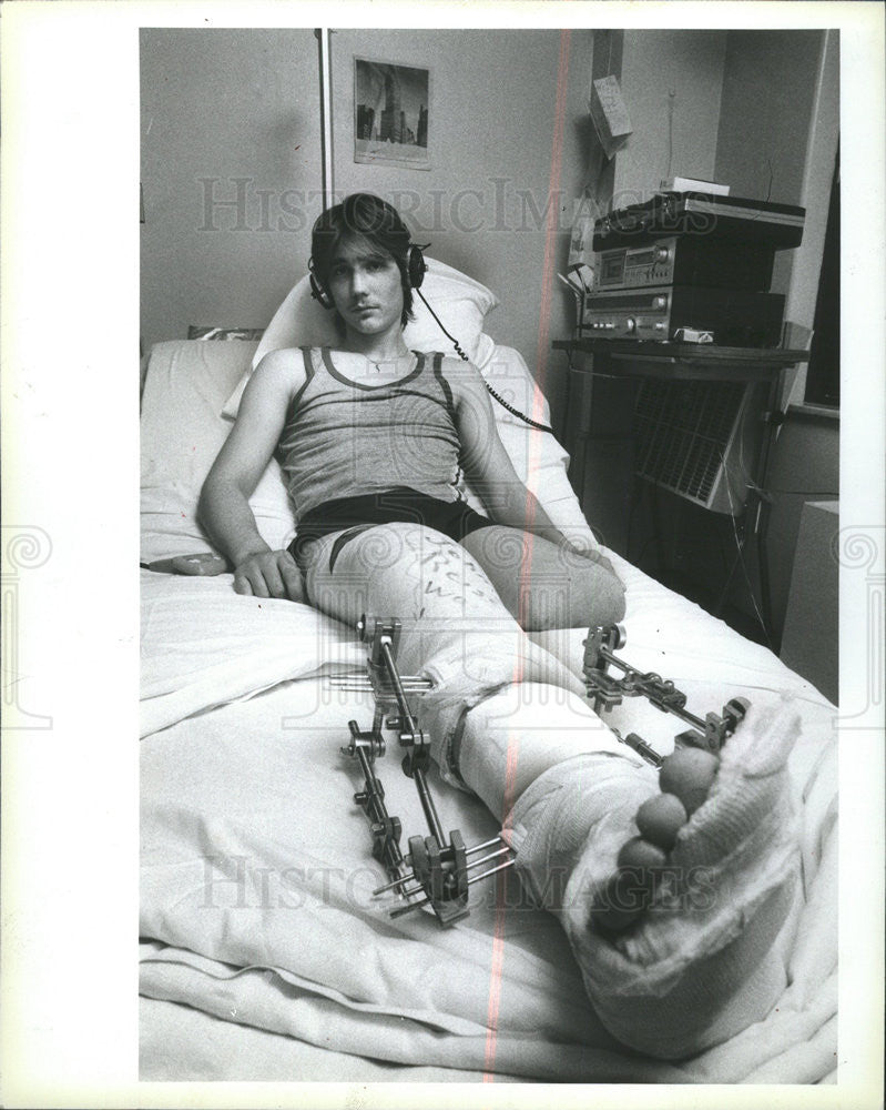 1983 Press Photo TODDY BORKENHAGEN LOST LEG - Historic Images