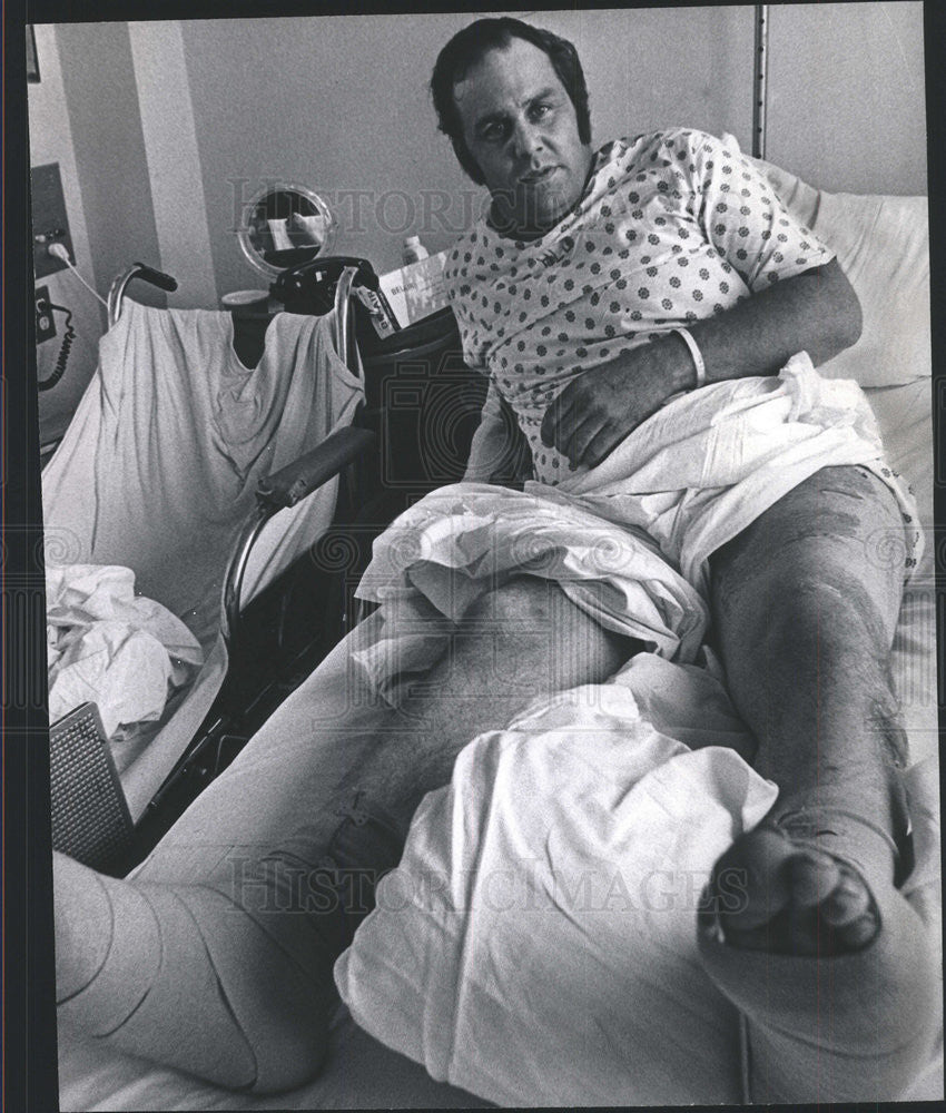 1972 Press Photo Howard Lapp Patient Skokie Valley Community Hospital - Historic Images