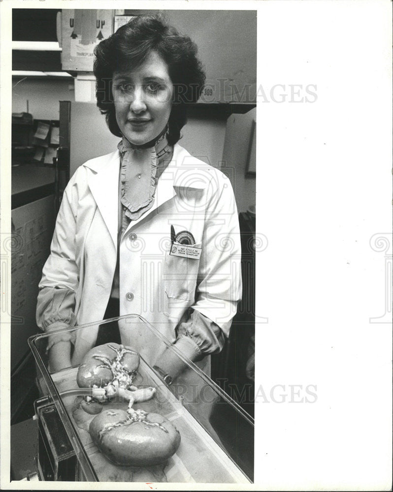 1983 Press Photo Amy Peele Coordinator of an Organ Recovery Program - Historic Images