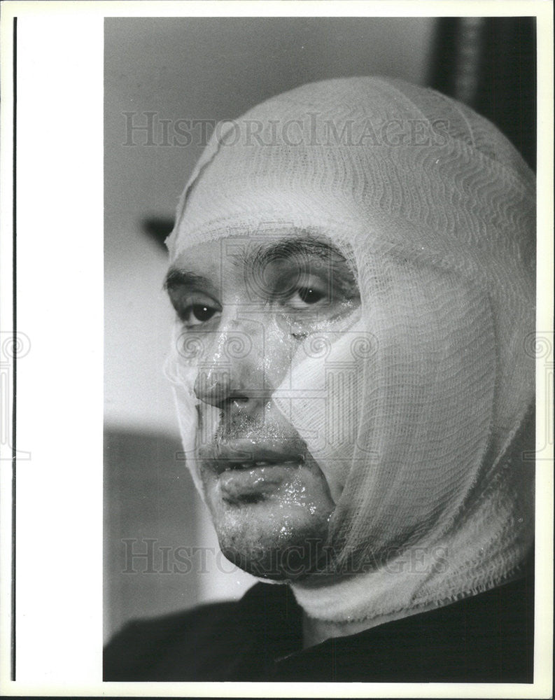 1985 Press Photo Fireman Sam Lasco Head Bandaged Leaves Hospital - Historic Images