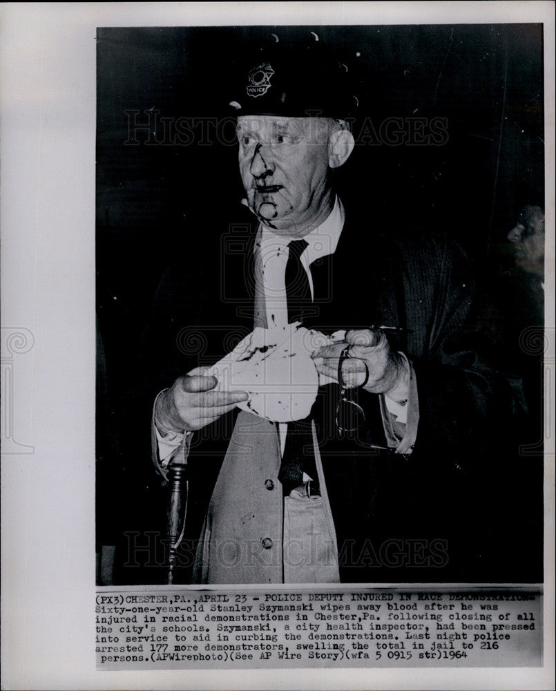 1964 Press Photo Police Dep. Stanley Szymanski injured in racial demonstrations - Historic Images