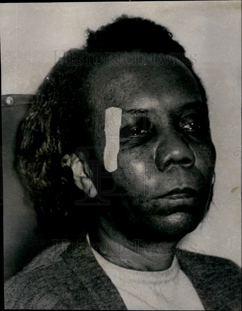 1966 Press Photo Mrs. Lucy McCarter injured L wreck 41st Indiana ...