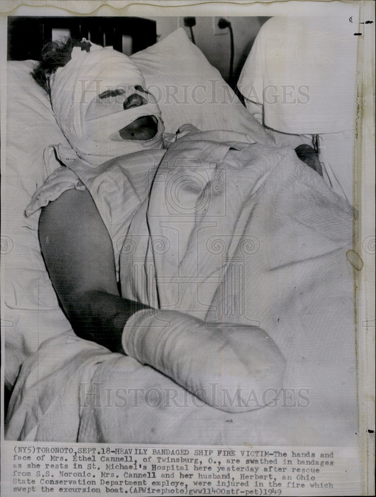 1949 Press Photo Heavily Bandaged Ship Fire Victim - Historic Images