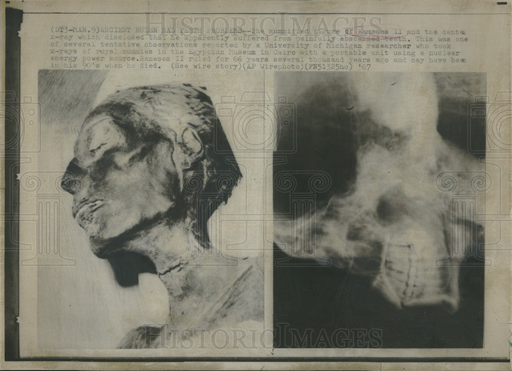 1967 Press Photo Mummified Figure Of Rameses II And Xray Abscessed Teeth - Historic Images